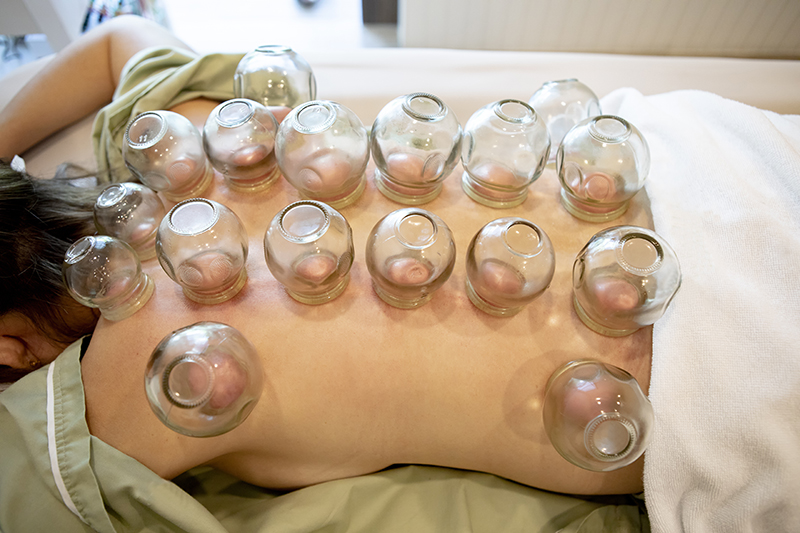 storyblocks-patience-undergoing-of-chinese-cupping-therapy_r8SnhoGcX